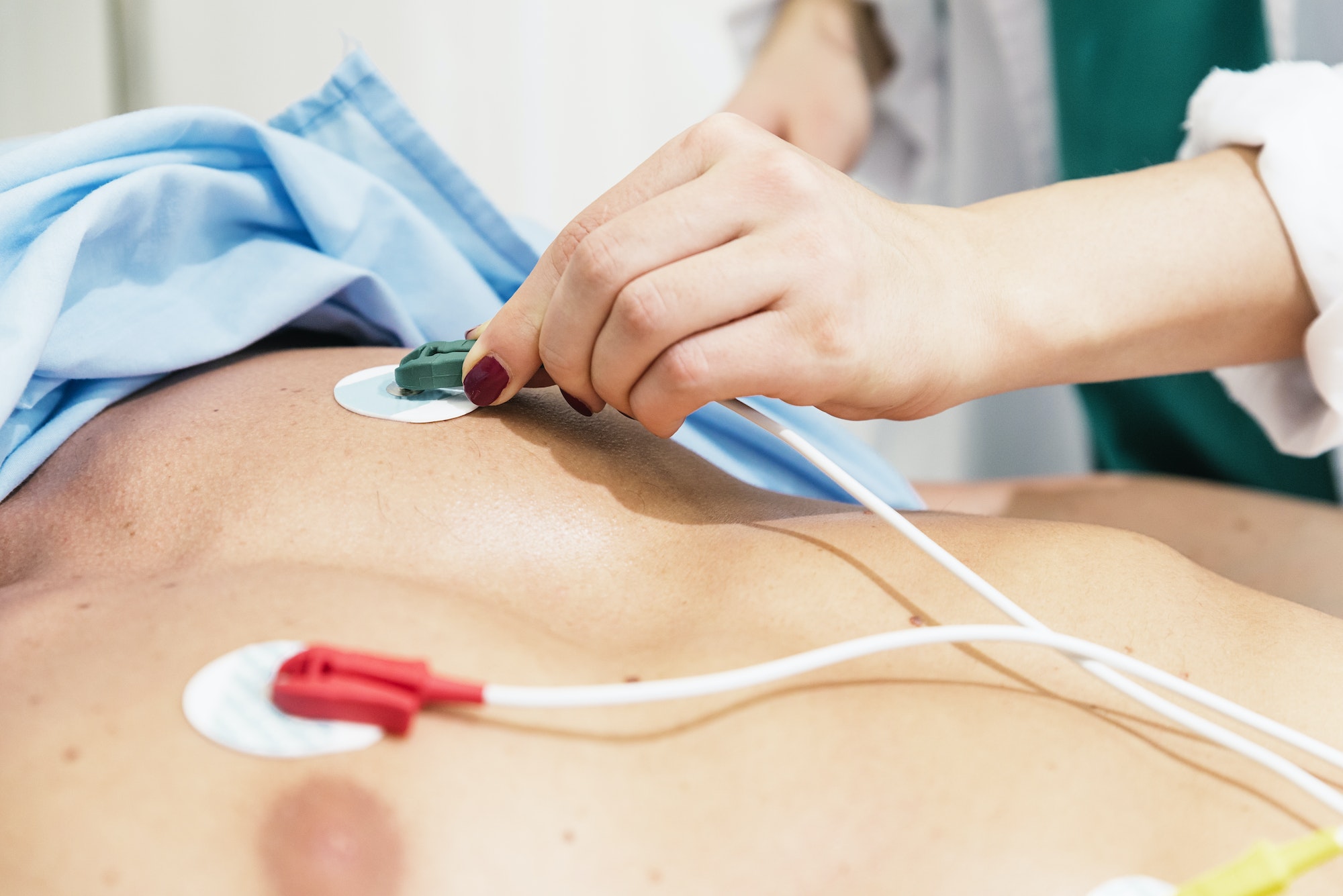 ECG electrodes on the patient