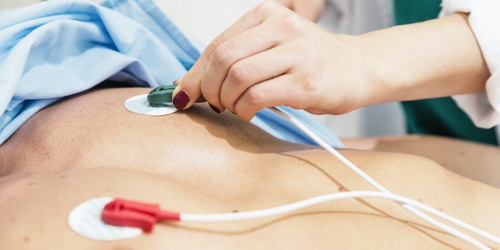 ECG electrodes on the patient